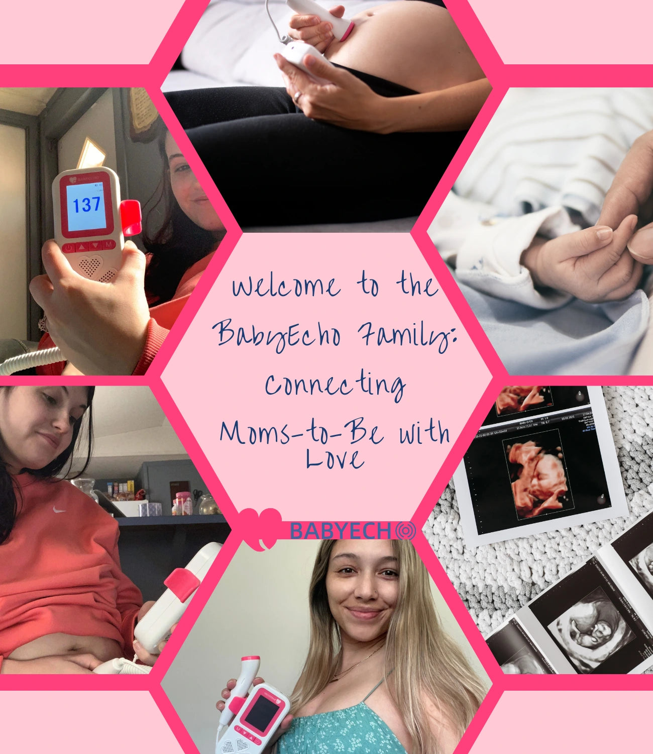 Moms to Be Share Your Pregnancy Moments with BabyEcho